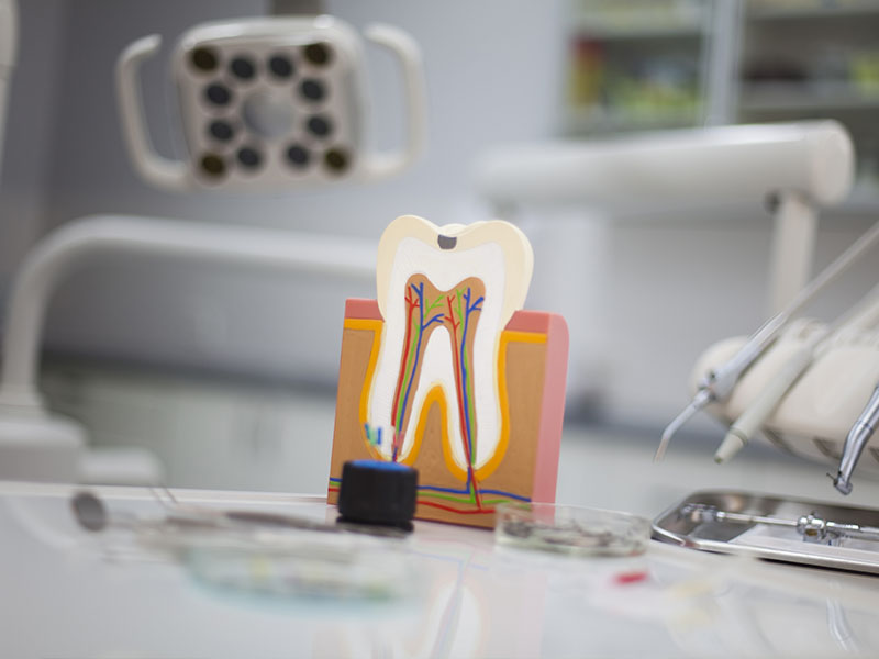Epident | Dental Bridges, Laser Dentistry and Extractions